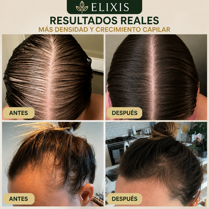 Tratamiento para el crecimiento del cabello con aceite natural (Edición limitada)