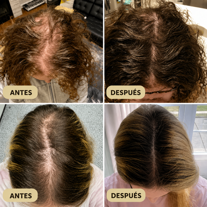 Tratamiento para el crecimiento del cabello con aceite natural (Edición limitada)